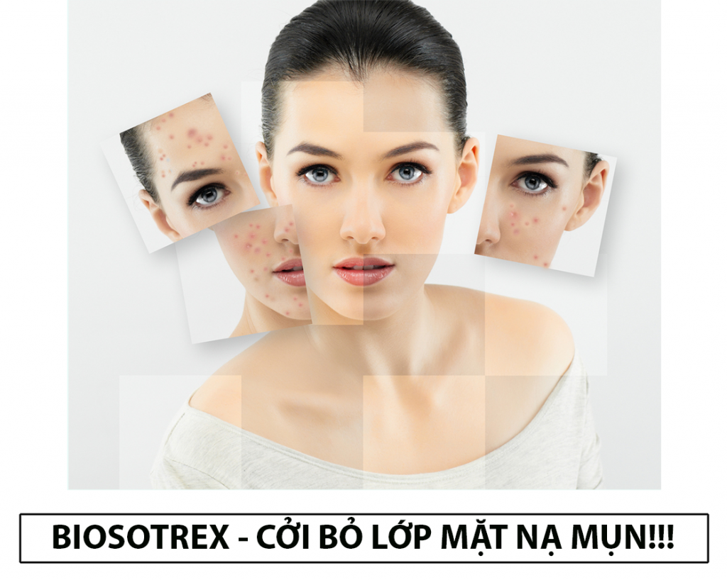 Viên uống trị mụn Biosotrex Isotretinoin sẽ ngay lập tức loại bỏ mọi loại mụn ra khỏi da một cách dễ dàng và an toàn, giúp da mềm mịn, tươi trẻ.