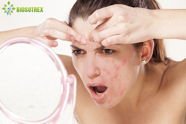 biosotrex có tốt không