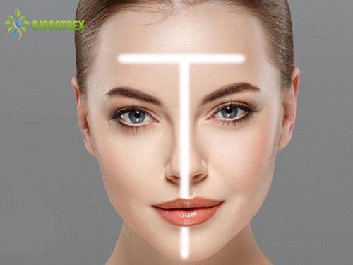 Tổng Hợp 10 Lý Do Khiến Mụn Đầu Đen Không Ngừng Xuất Hiện