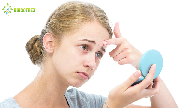 Tại sao chăm sóc da cẩn thận nhưng mụn vẫn ghé thăm thường xuyên?
