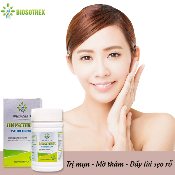 Bật mí 5 cách trị mụn nhanh chóng từ tỏi