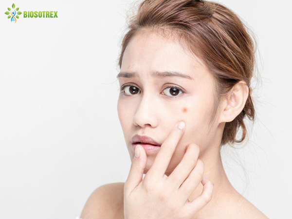 Những sai lầm thường mắc phải trong điều trị mụn