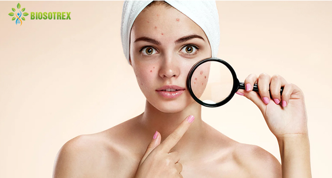 Mụn mủ có nguy hiểm không? Đâu là cách điều trị mụn mủ tận gốc