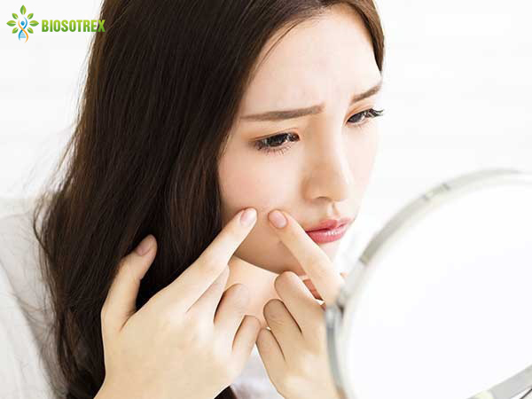 Những sai lầm thường mắc phải trong điều trị mụn