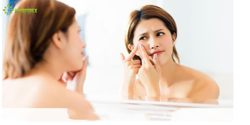 Nguyên nhân phổ biến gây mụn cám và cách xử lý hiệu quả